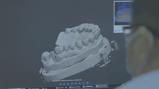 3D打印在口腔齿科领域都这么卷了吗？