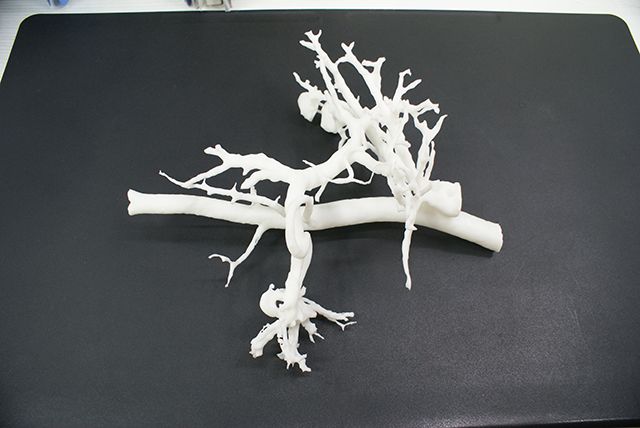 联泰答疑室 | 3D打印，我劝你在医疗行业别这么“嚣张”